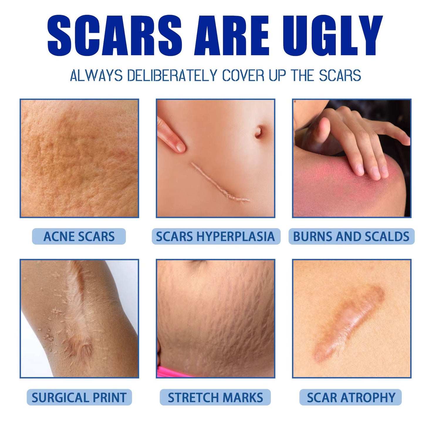 Scar Removal Cream ( Original Guaranteed )